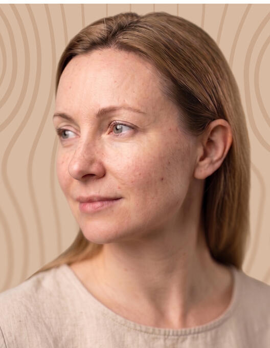 PHYSIOGEL Gesicht Frau