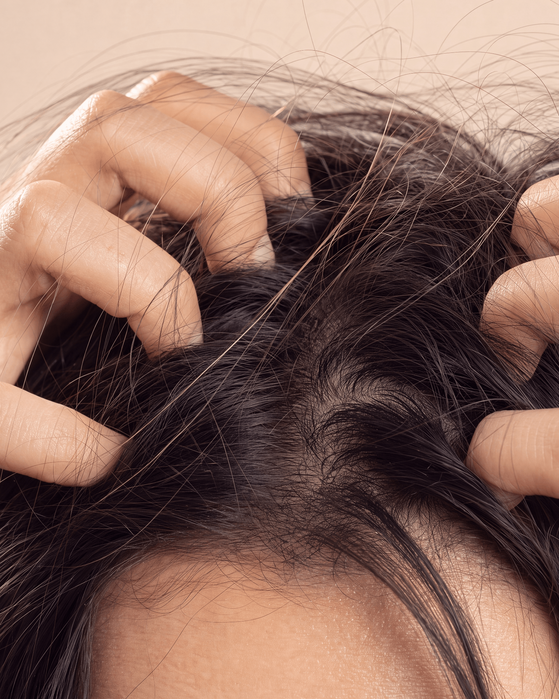 Neurodermitis auf der Kopfhaut belastet stark