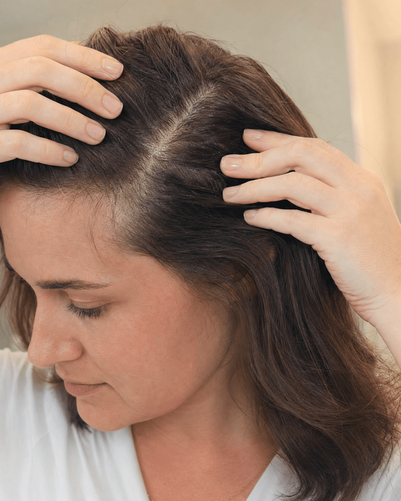 Tipps gegen trockene und juckende Kopfhaut