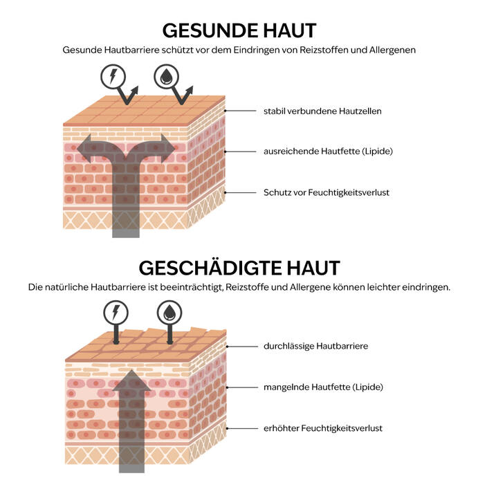 Warum trocknen Ellenbogen und Knie besonders schnell aus?